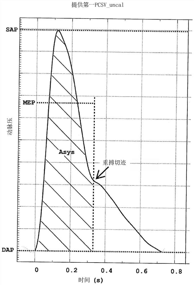 Method for determining cardiac stroke volume