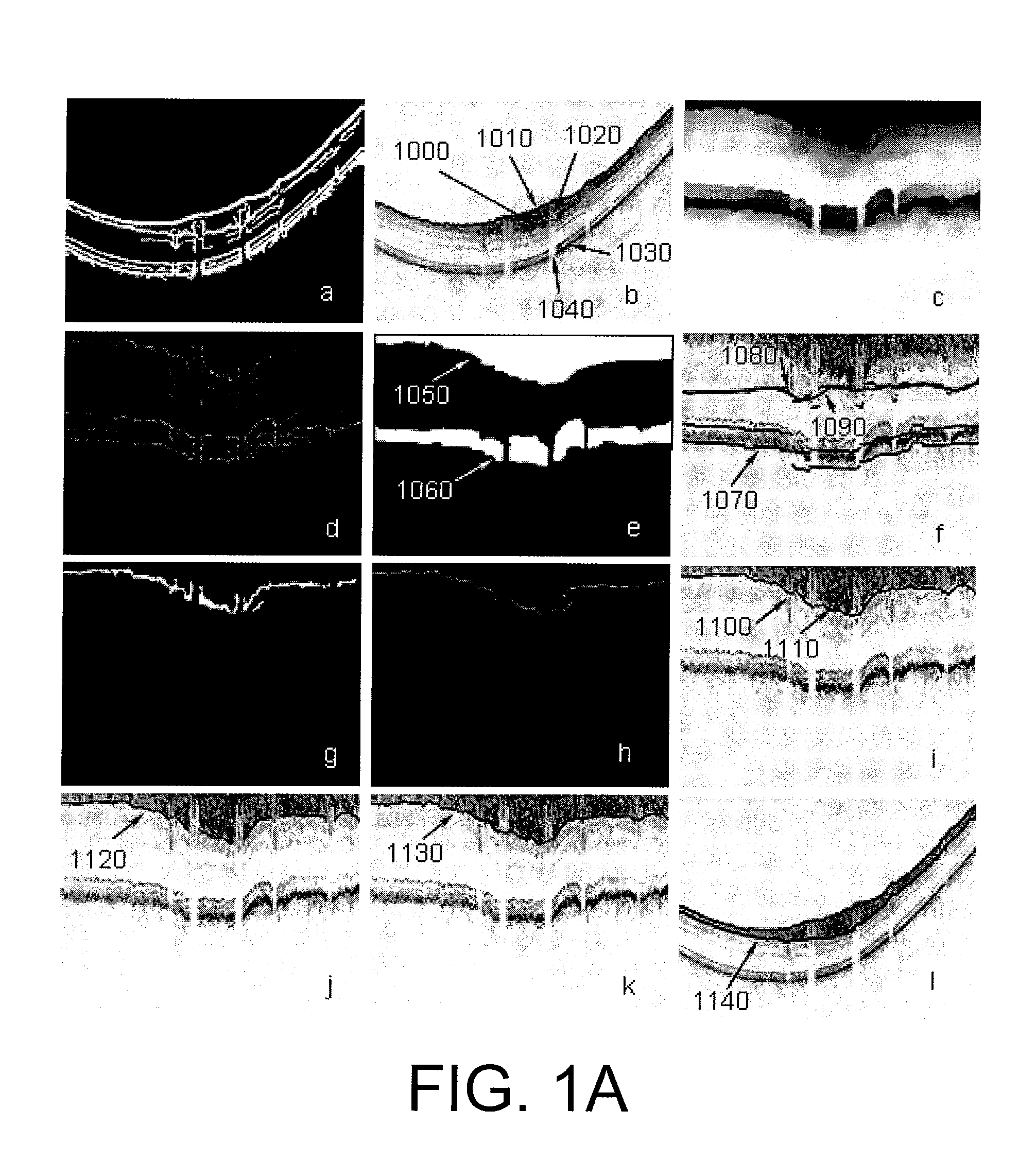 Processes, arrangements and systems for providing a fiber layer thickness map based on optical coherence tomography images