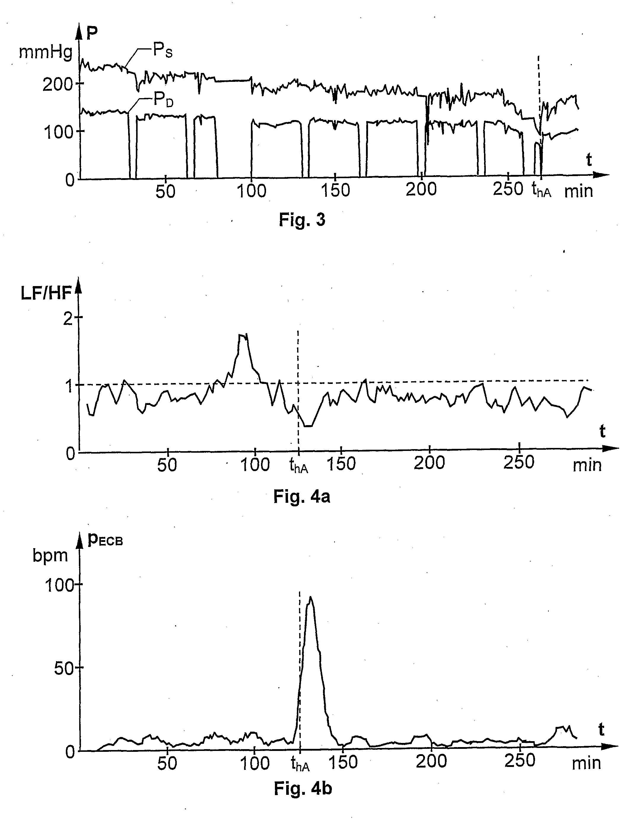 Detection of drastic blood pressure changes