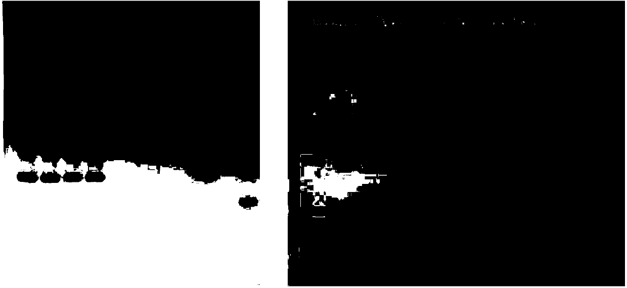 Fluorescent quantitative PCR (Polymerase Chain Reaction) primers for detecting mycoplasma pneumoniae (MP) and application thereof