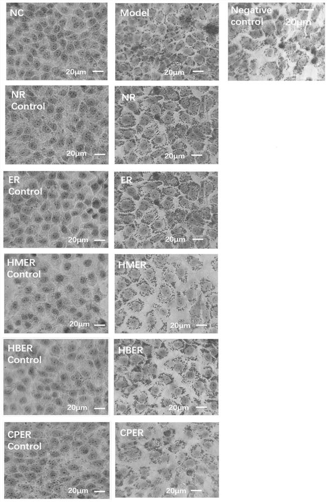 Multi-component instant functional recombinant rice capable of losing weight and lowering lipid and preparation method of multi-component instant functional recombinant rice