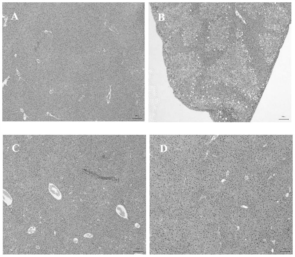 Lactobacillus salivarius MG-587 and application thereof