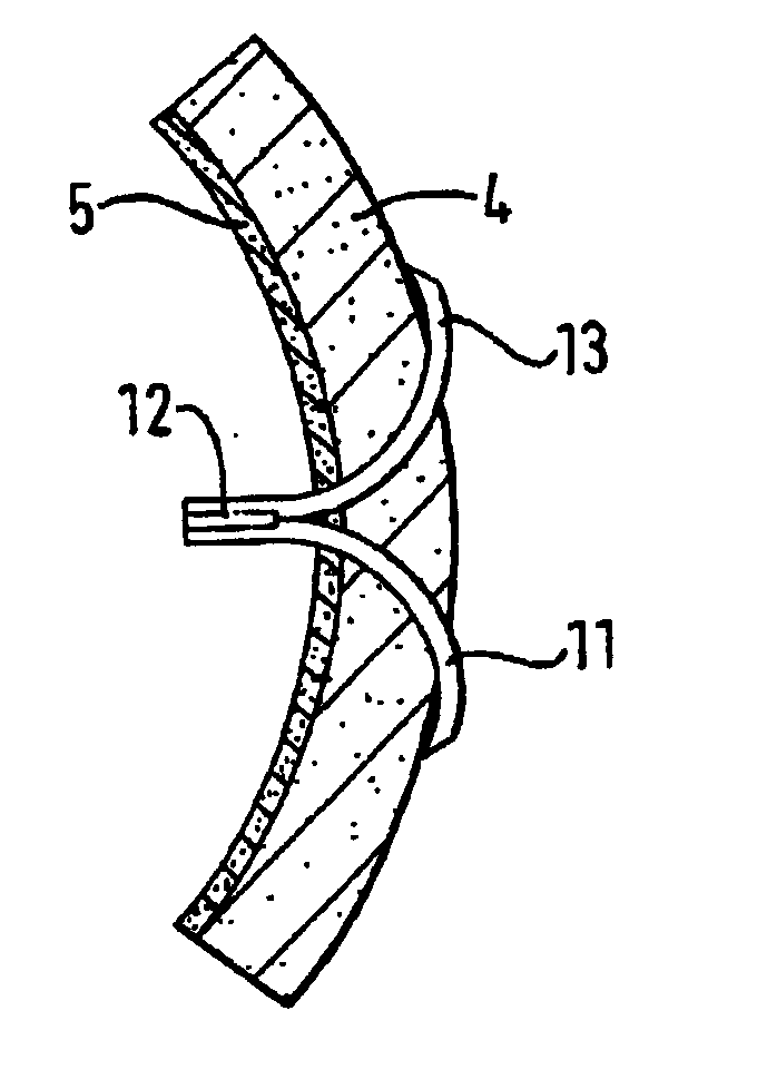 Device for the repair of arteries