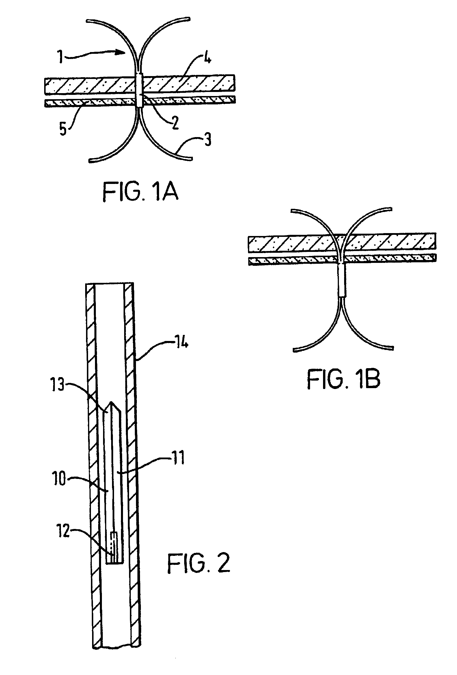 Device for the repair of arteries