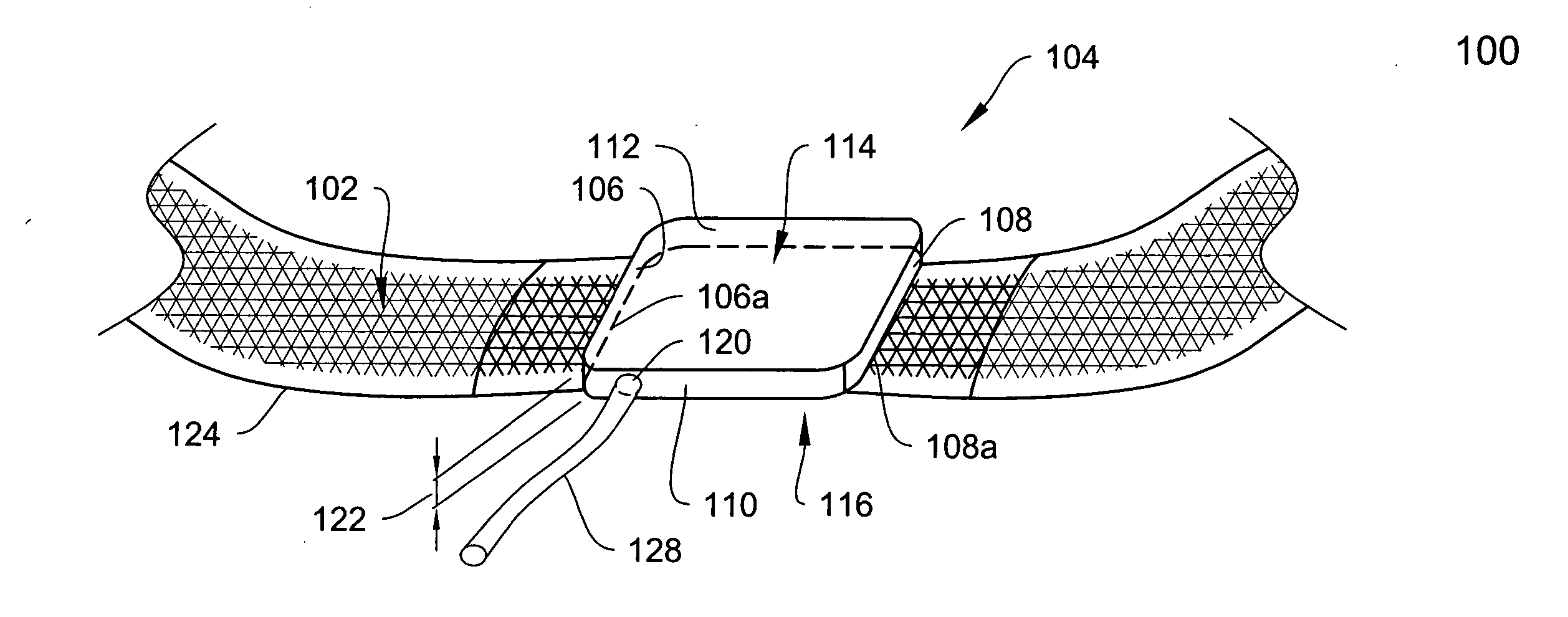 Adjustable surgical sling