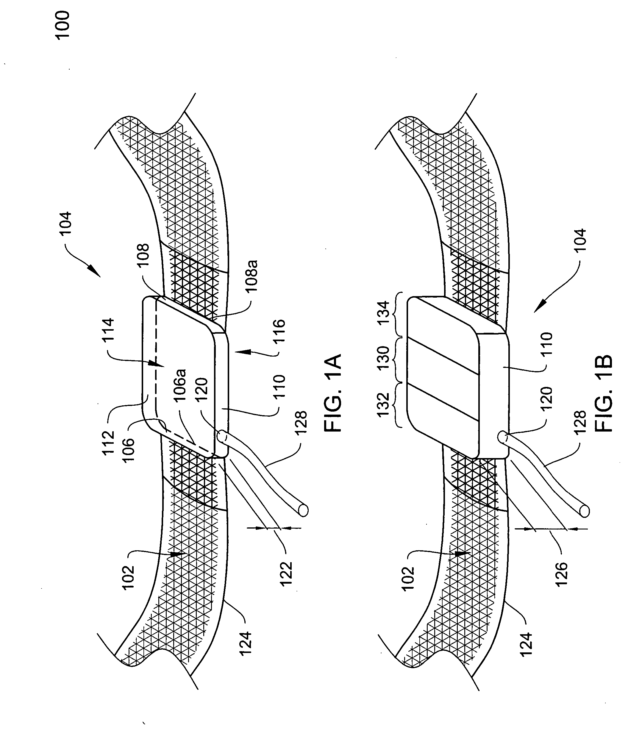 Adjustable surgical sling