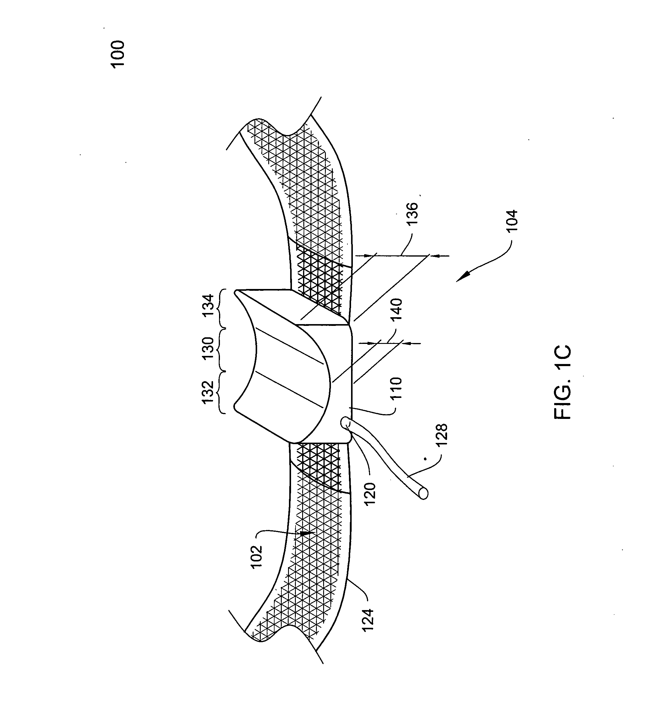 Adjustable surgical sling