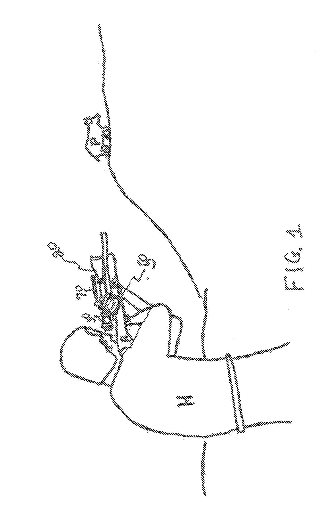 Video Capture Attachment and Monitor for Optical Viewing Instrument