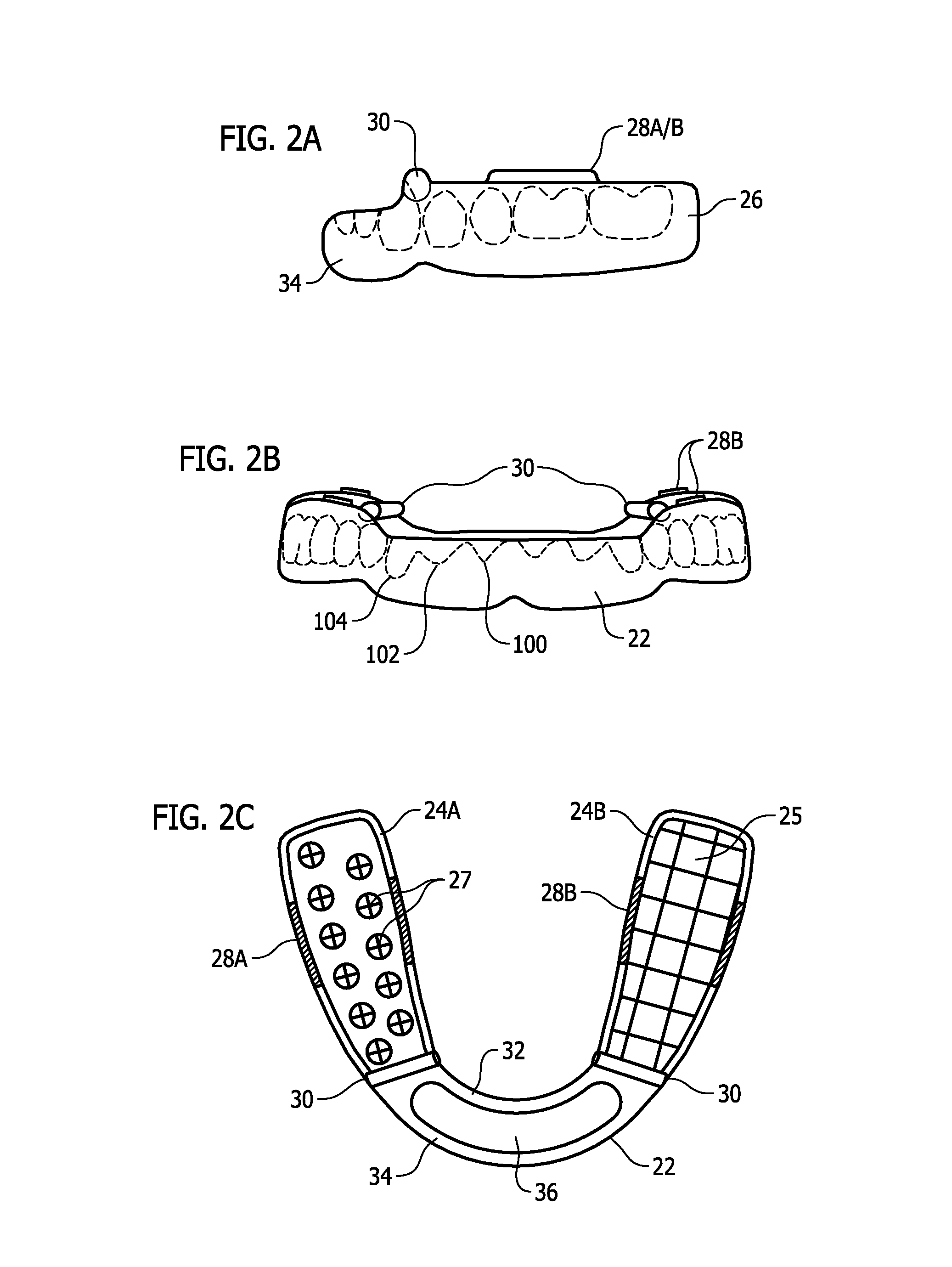 Repositioning Appliance