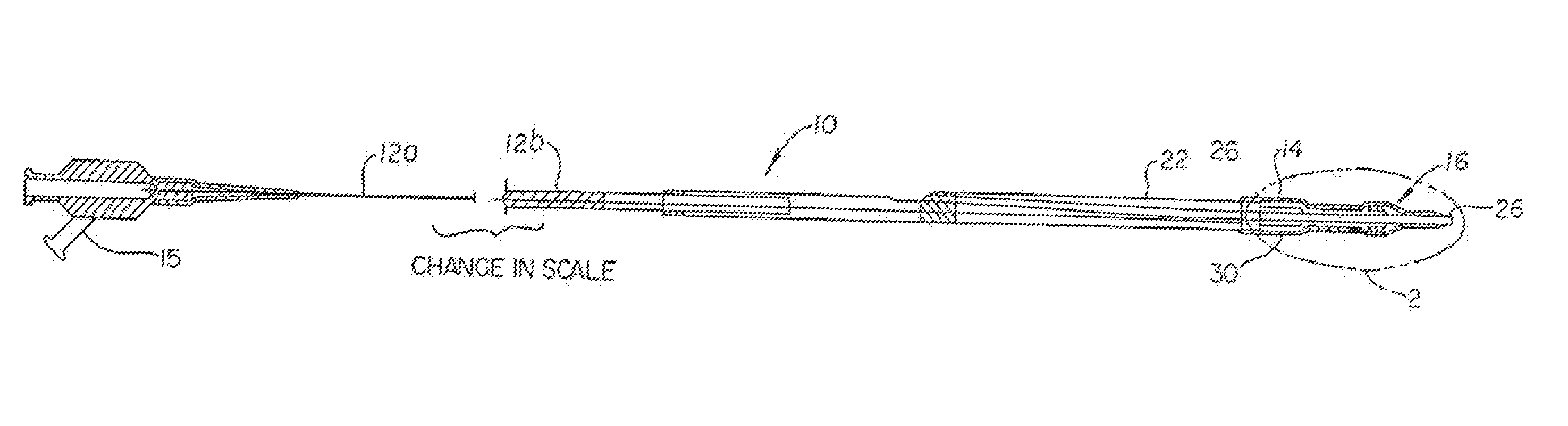 Stent Delivery System Having Stent Securement Apparatus