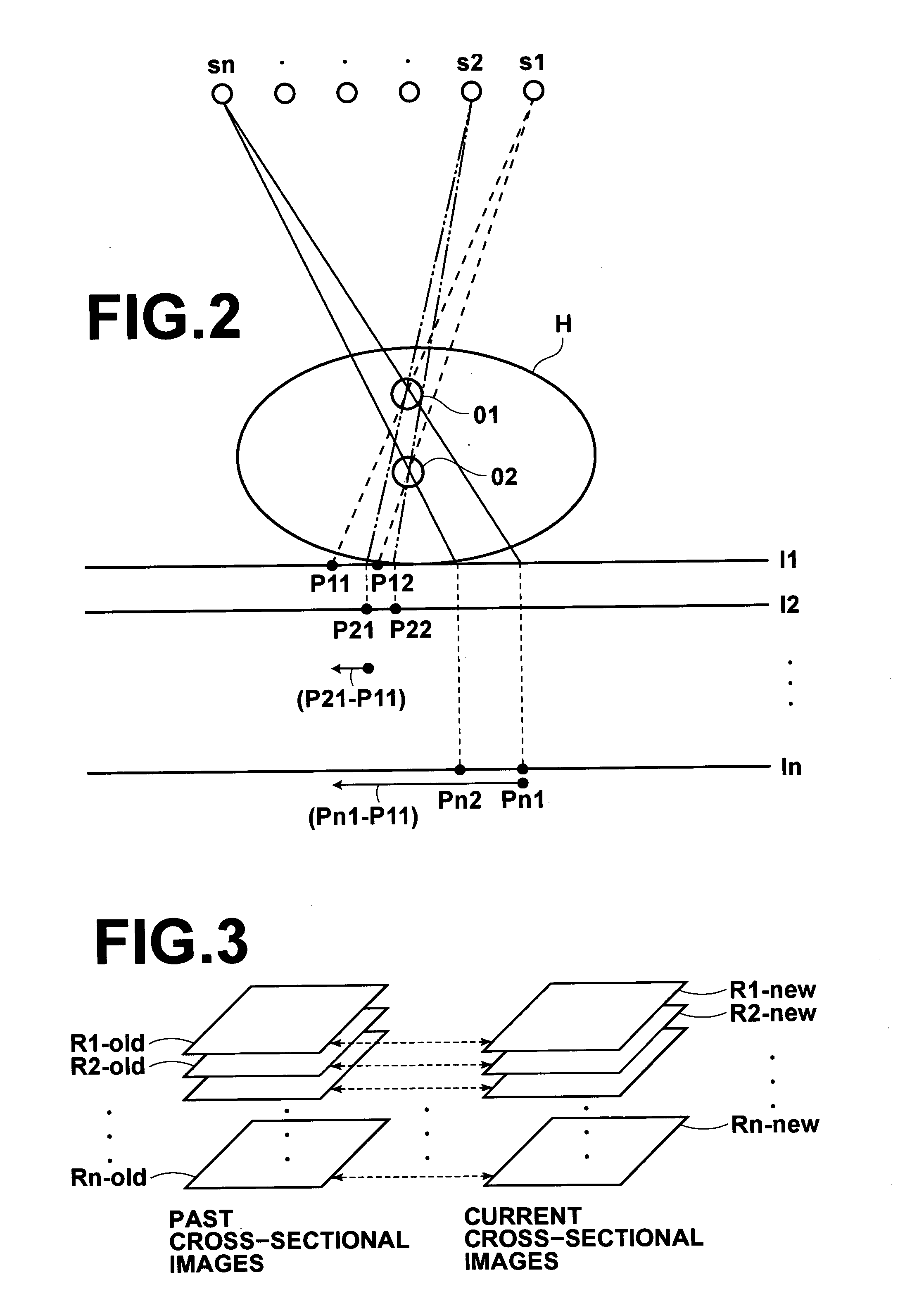 Apparatus, method, and program for producing subtraction images