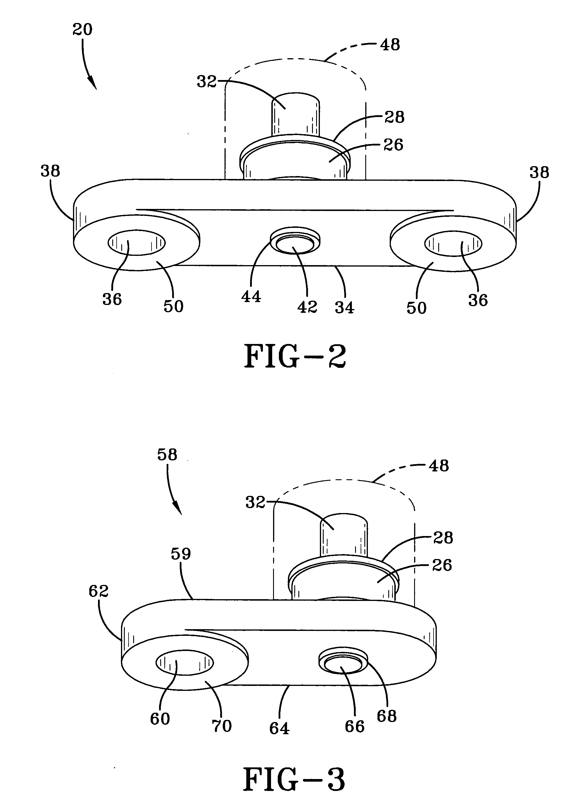 Magnetostrictive stress wave sensor