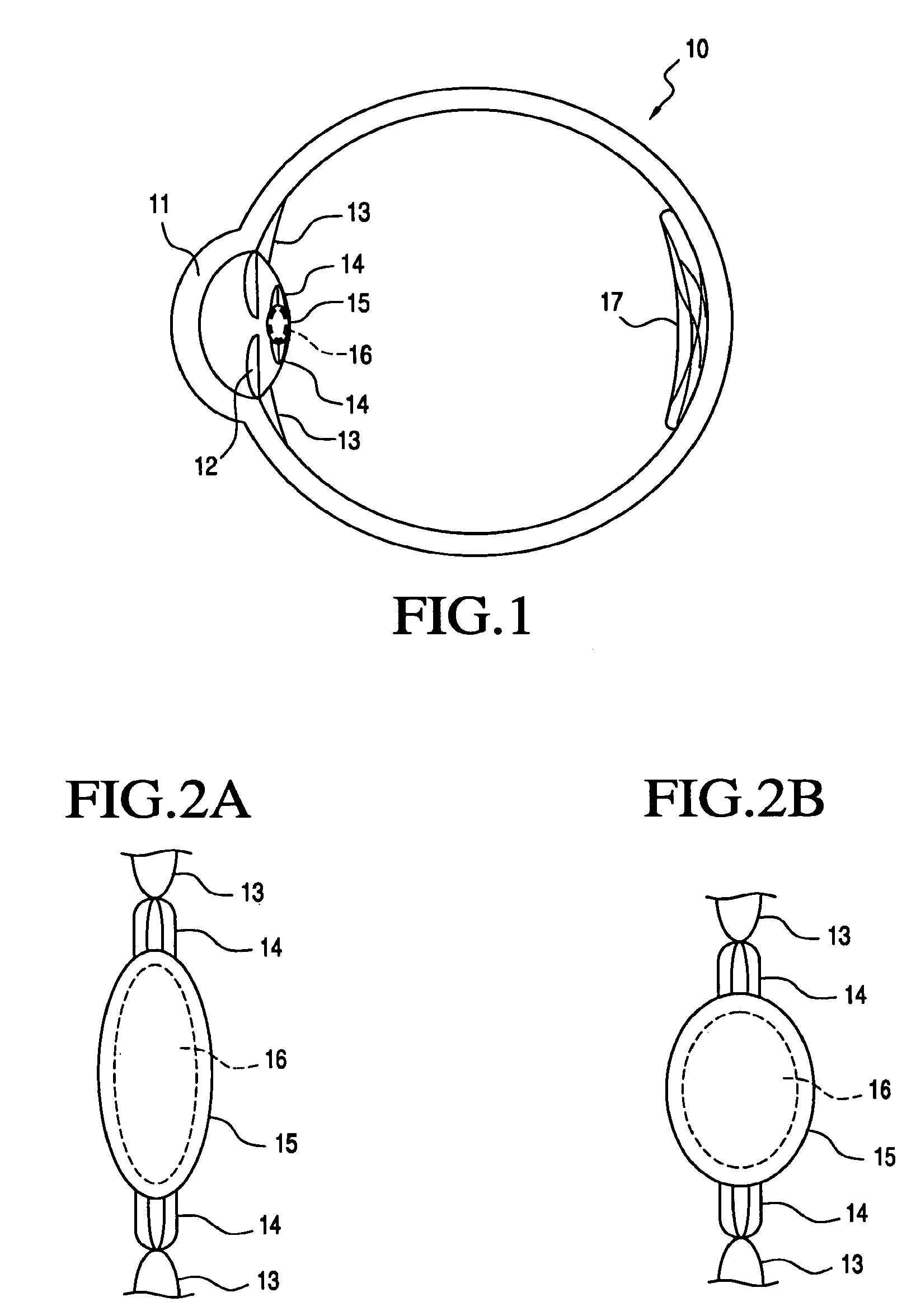 Accommodating intraocular lens system and method