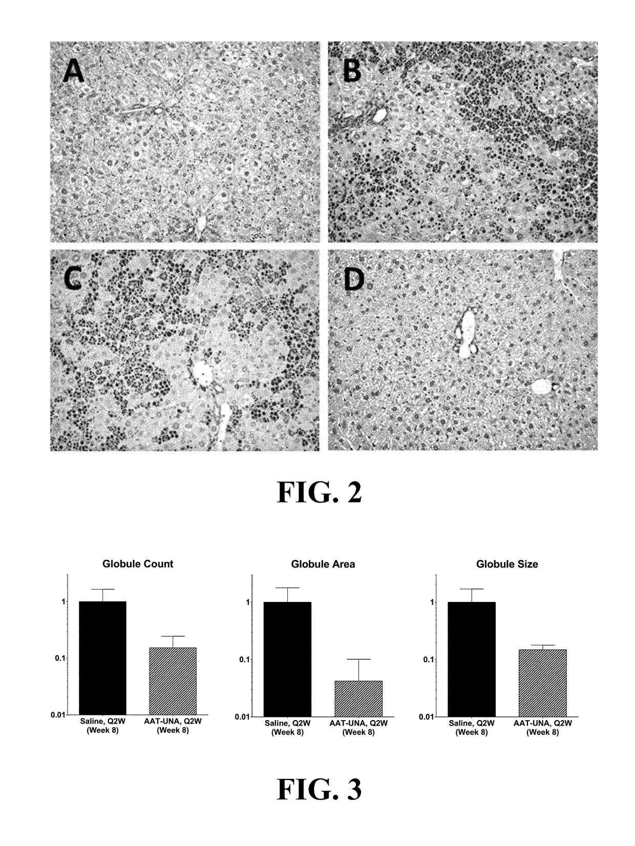 Methods Of Treatment For Alpha-1 Antitrypsin Deficiency