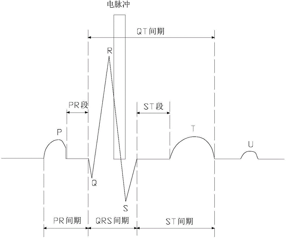 Electrocardiogram monitoring and automatic protection device for electrical ablation of tumors