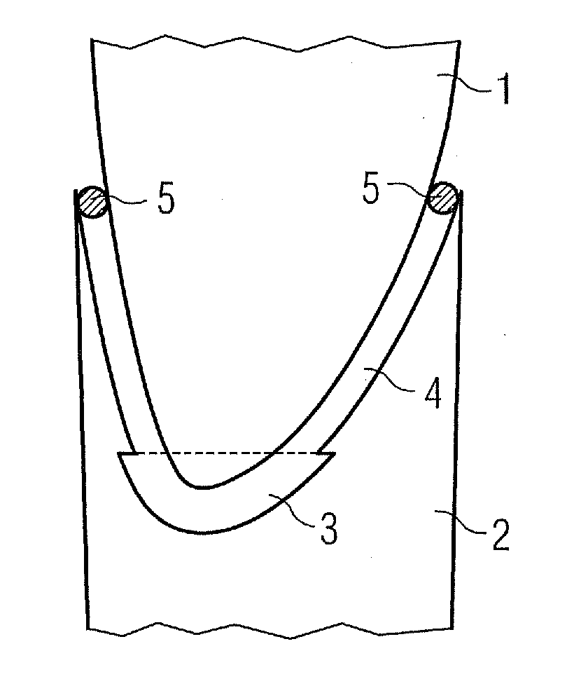 Arrangement and method to retrofit a wind turbine