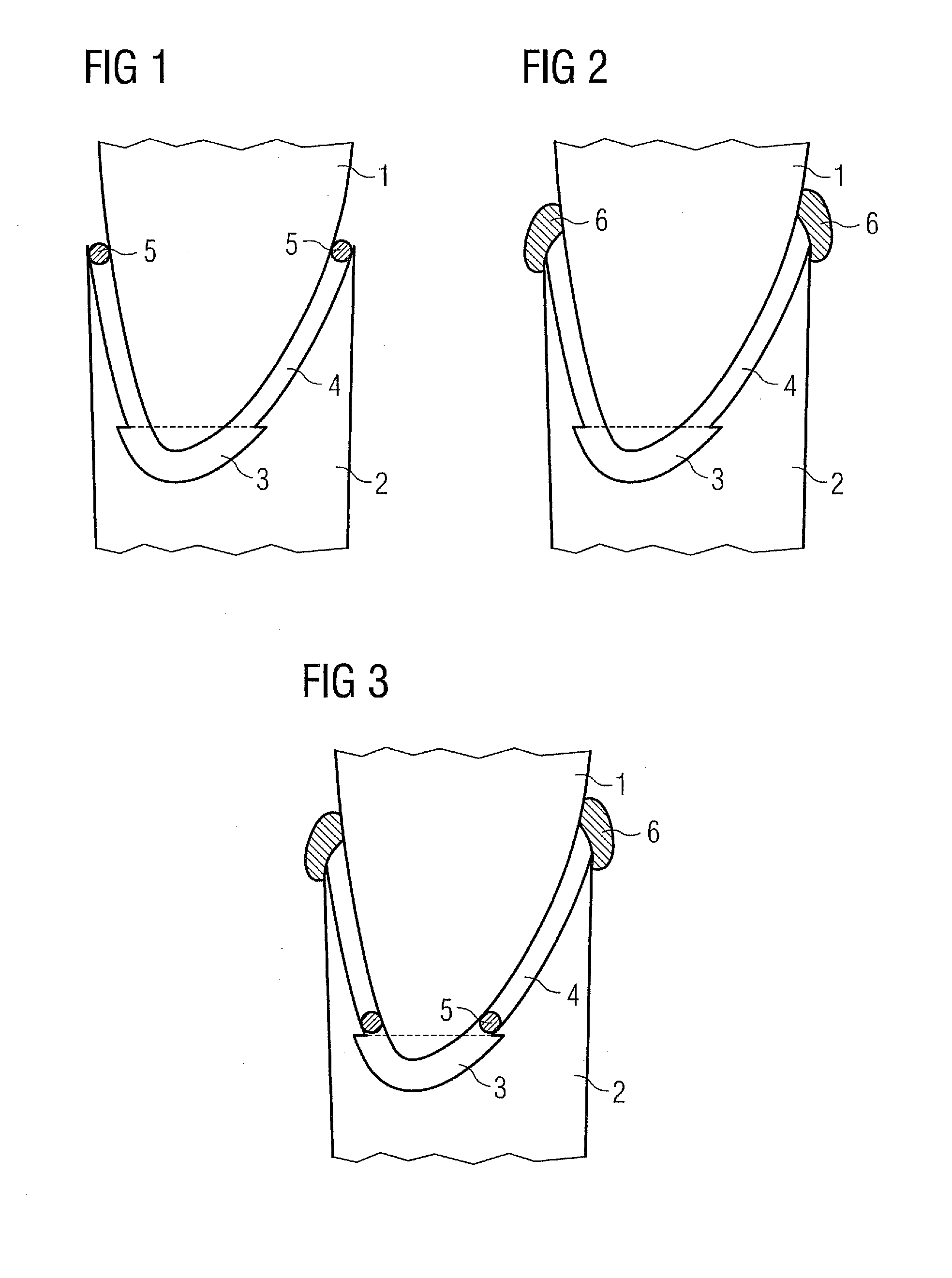 Arrangement and method to retrofit a wind turbine