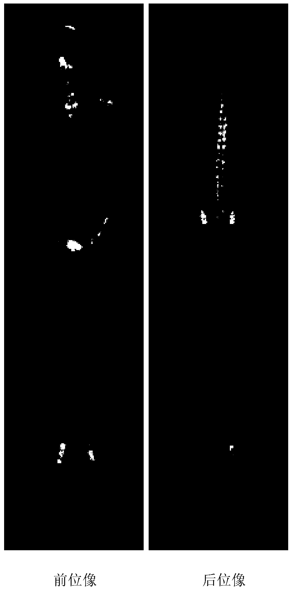 Medical image focus detection positioning method and device, electronic device and storage medium