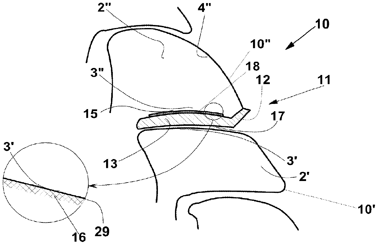 Improved partial endoprosthesis device for vertebral joint