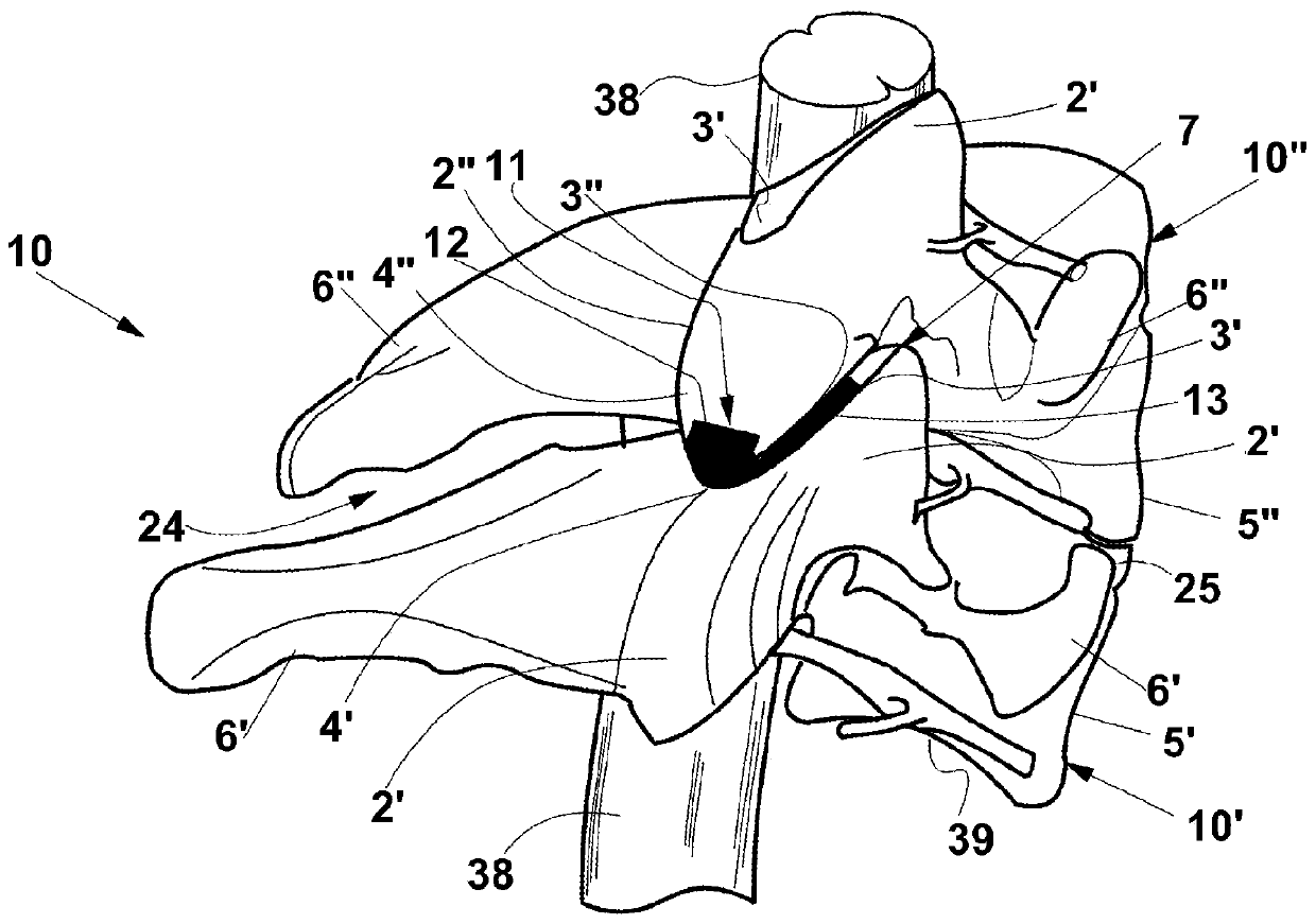 Improved partial endoprosthesis device for vertebral joint