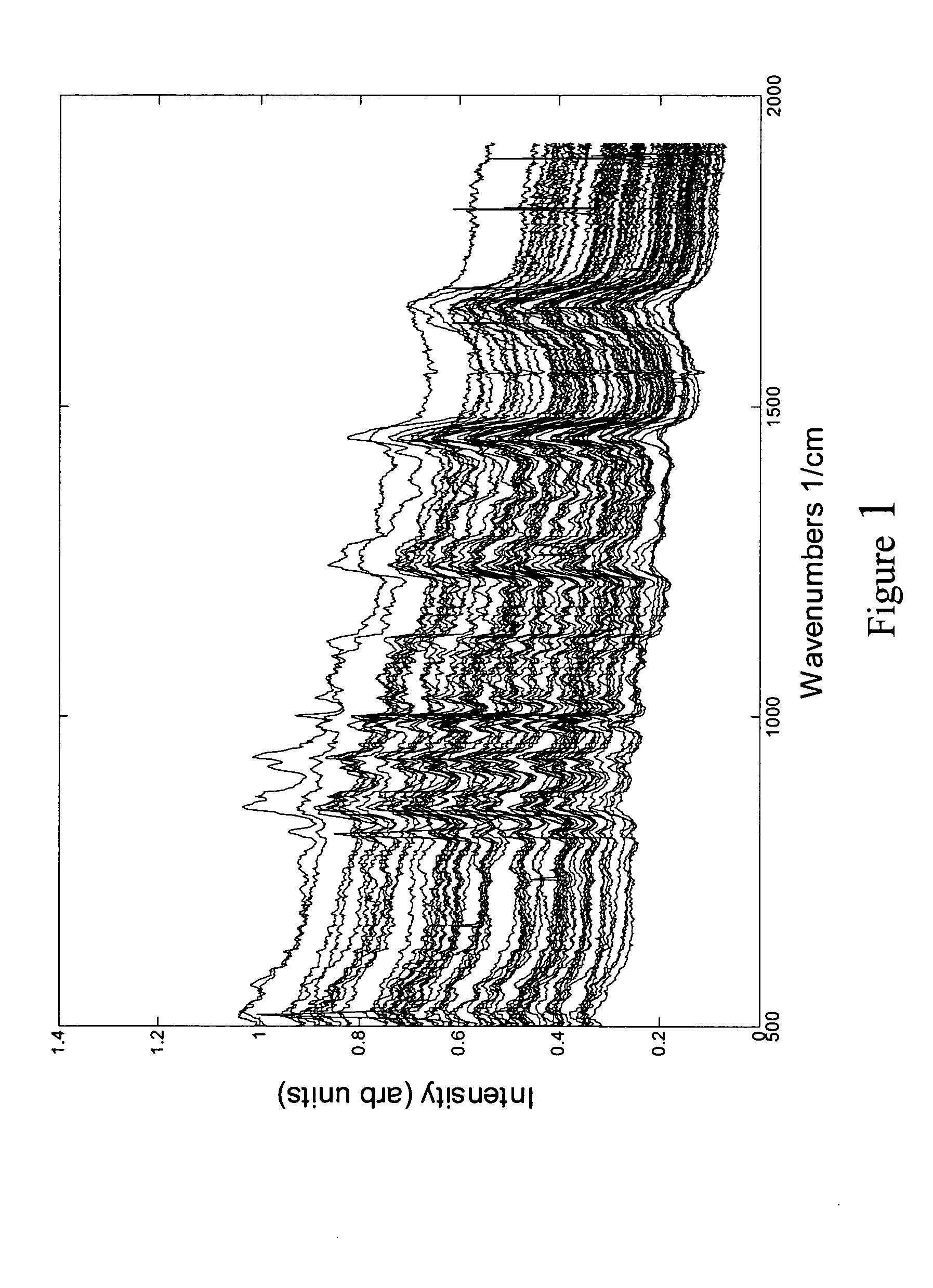 Determination of disease state using Raman Spectroscopy of tissue