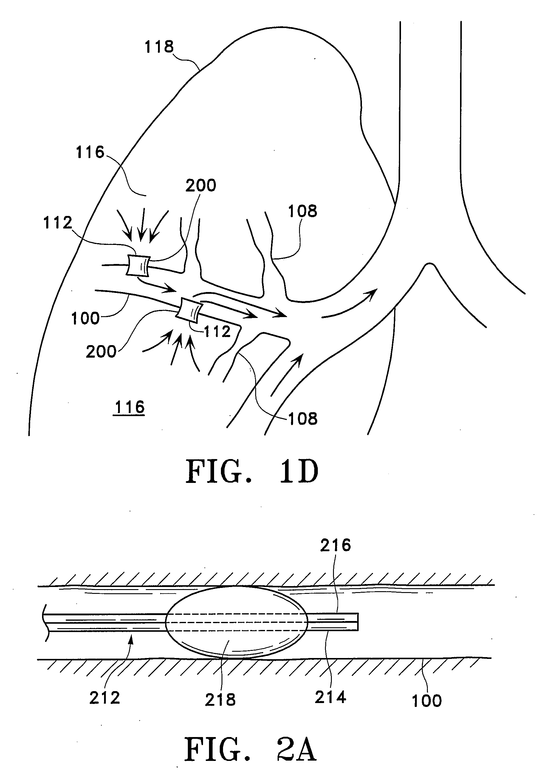 Devices and methods for maintaining collateral channels in tissue