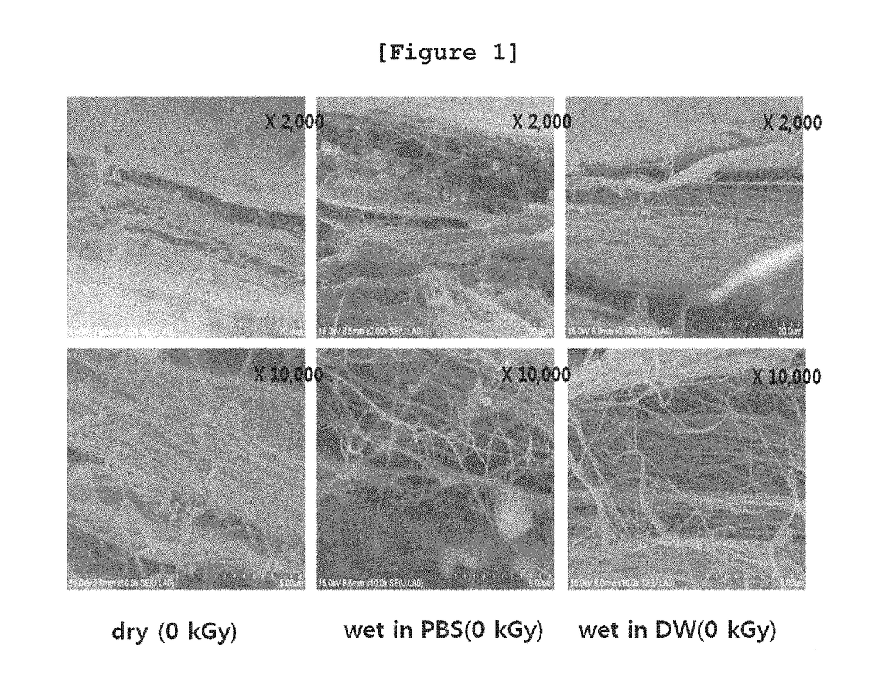 Biodegradable control of bacterial cellulose by radiation technology and absorbable periodontal material using same