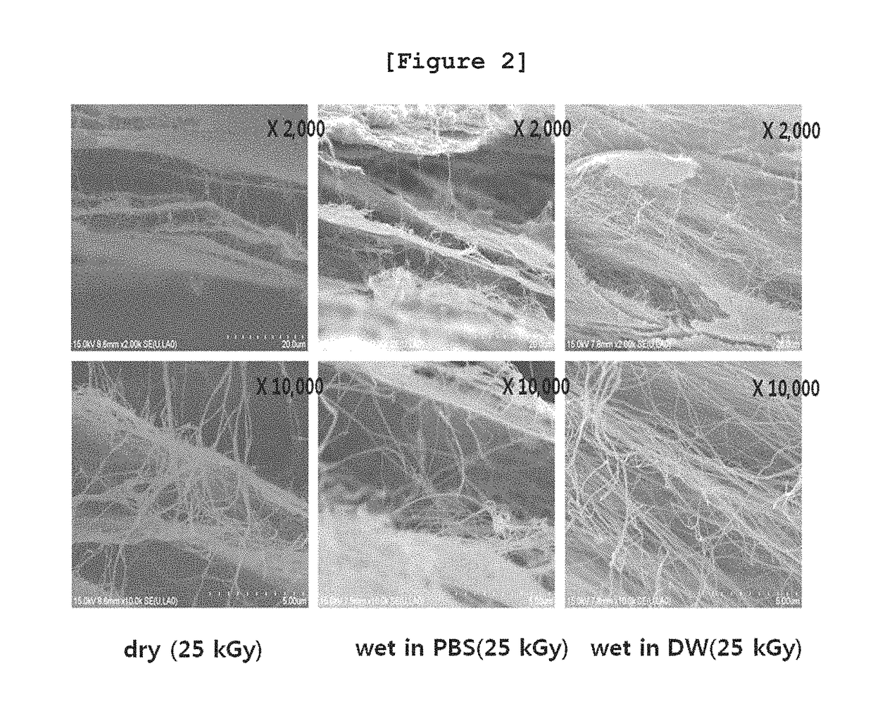 Biodegradable control of bacterial cellulose by radiation technology and absorbable periodontal material using same