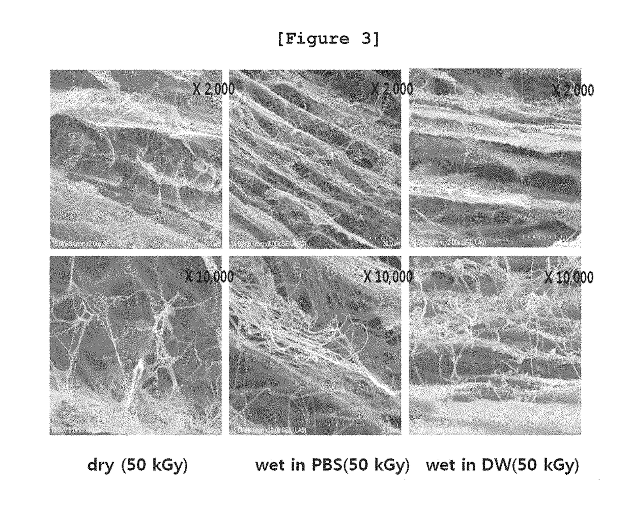 Biodegradable control of bacterial cellulose by radiation technology and absorbable periodontal material using same