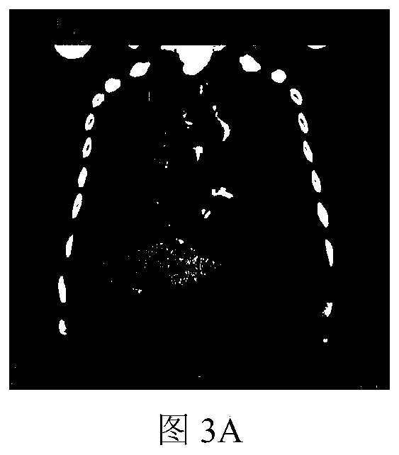 Region-of-interest medical image chaotic encryption method based on information entropy update key