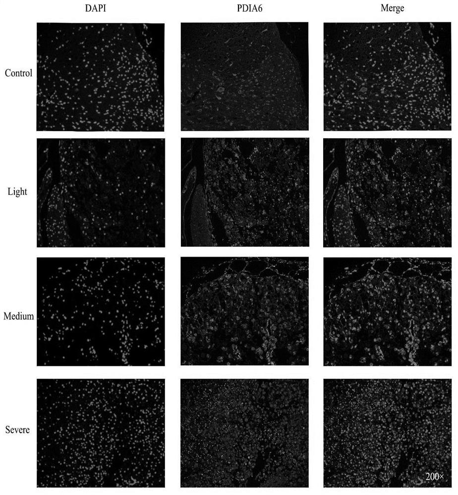 Application of PDIA6 in preparation of medicine for treating and repairing spinal cord injury