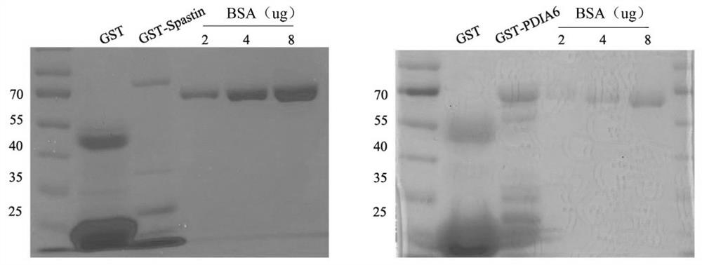 Application of PDIA6 in preparation of medicine for treating and repairing spinal cord injury