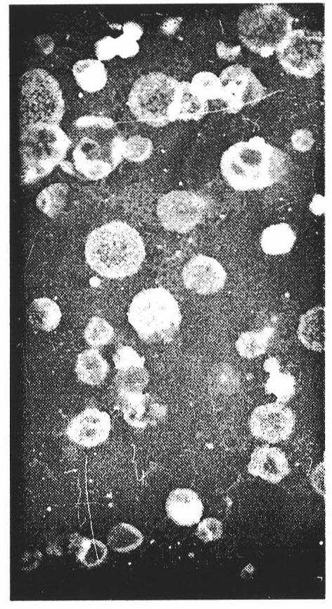 Curcumin coated liposome preparation and preparation method thereof