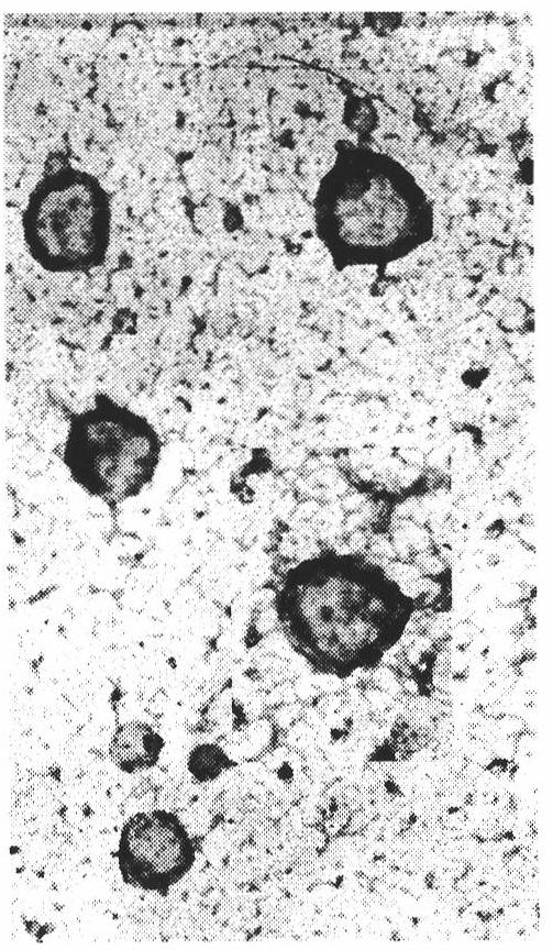 Curcumin coated liposome preparation and preparation method thereof