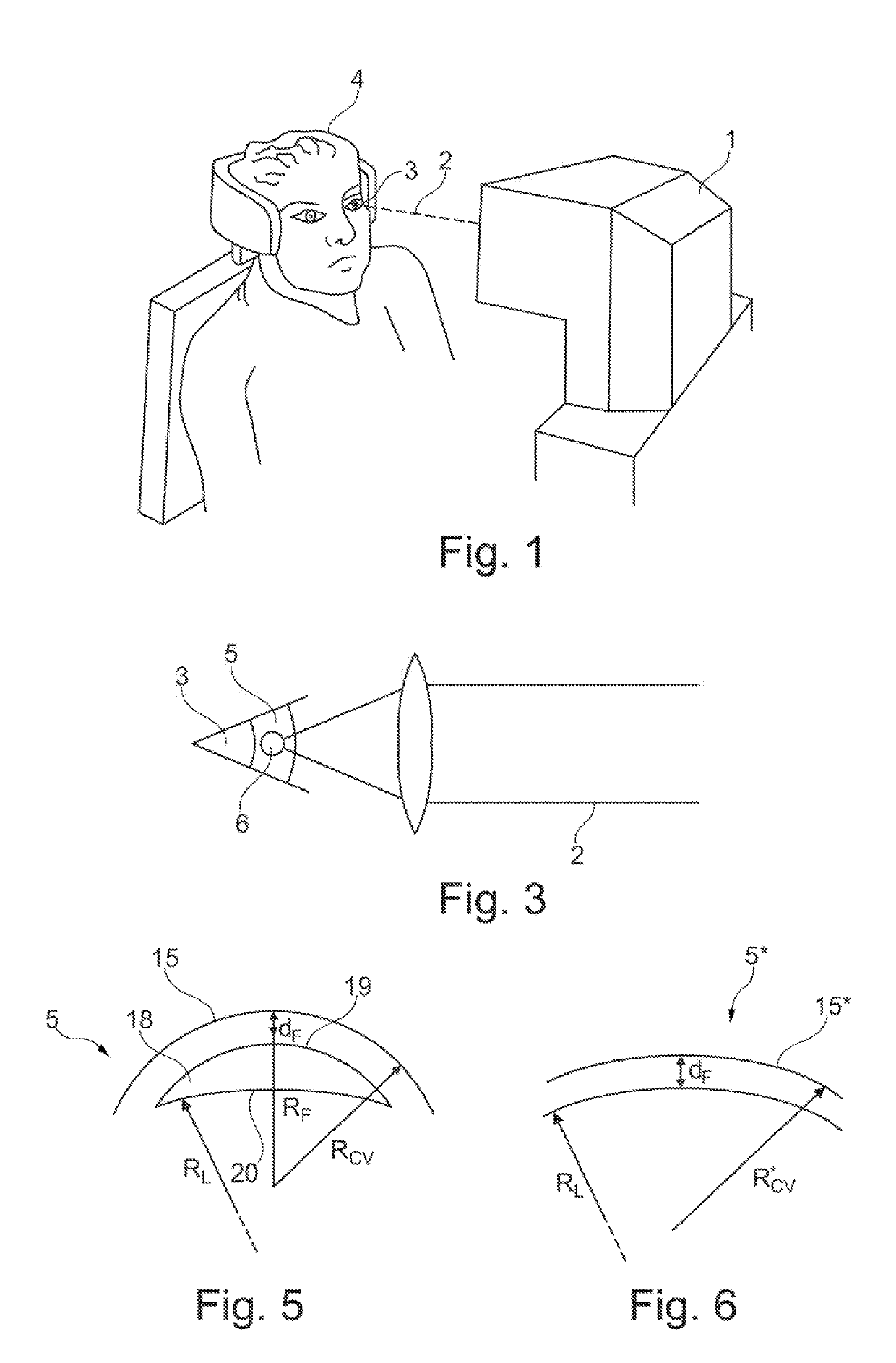 Device for surgically correcting ametropia of an eye and method for creating control data therefor