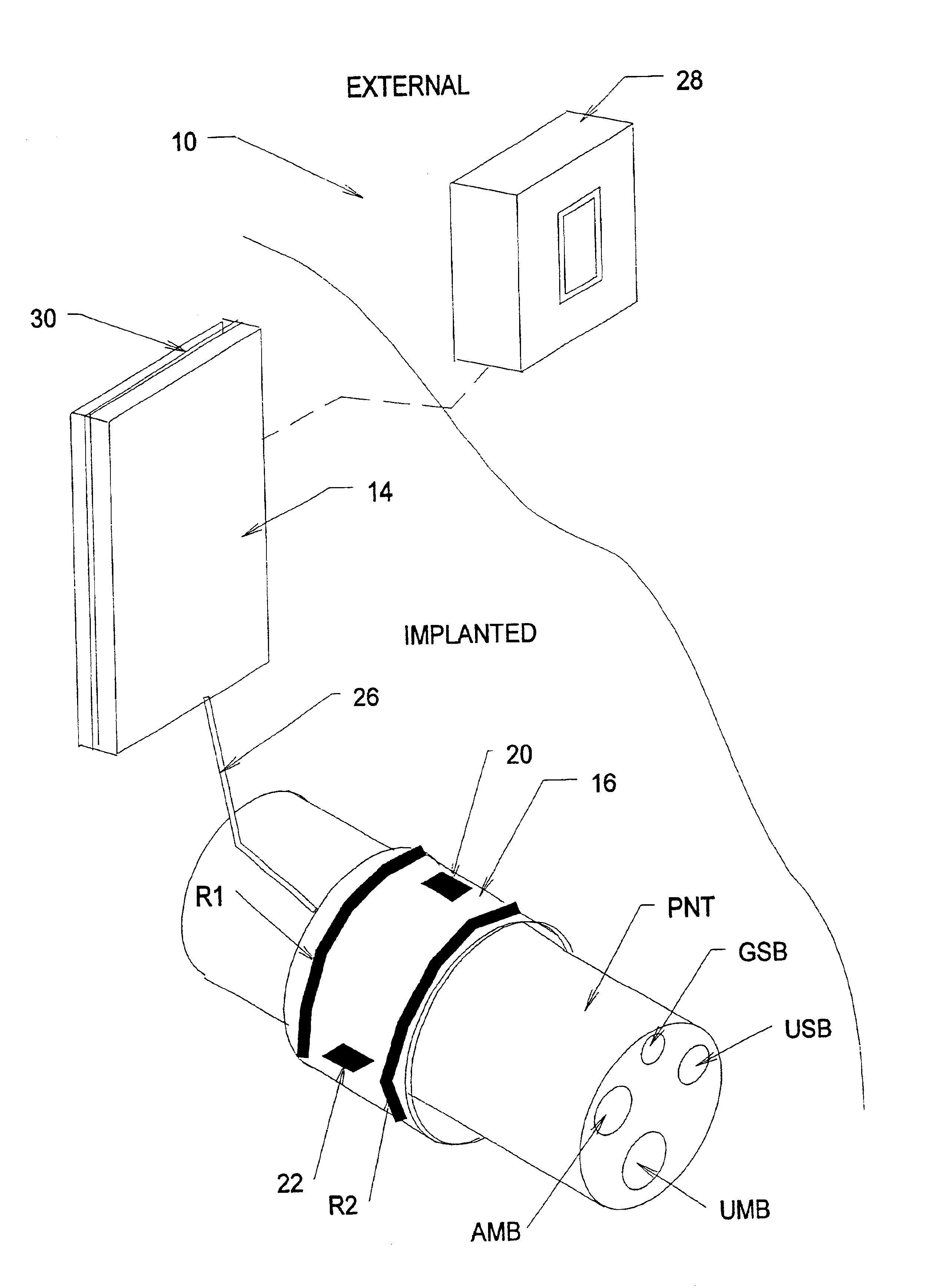 Systems and methods for selectively stimulating components in, on, or near the pudendal nerve or its branches to achieve selective physiologic responses