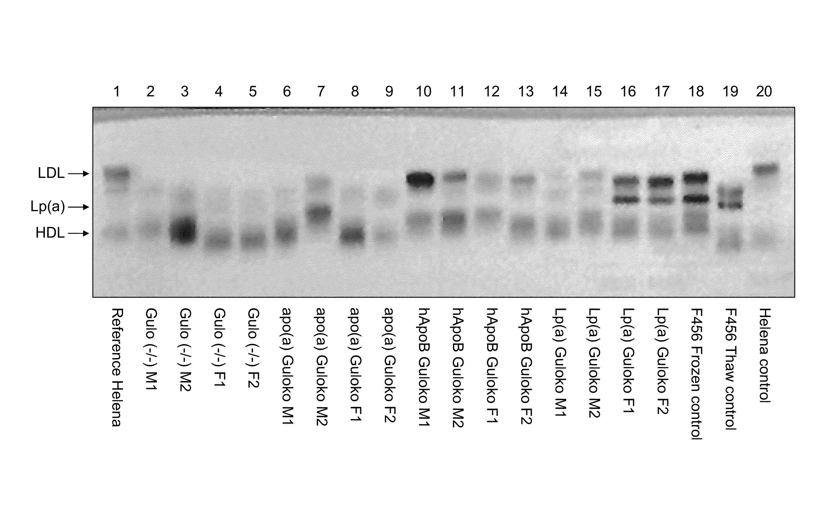 Transgenic mouse expressing human lipoprotein (a) with disabled vitamin c gene and its use as a disease treatment model