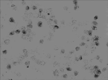 Kit for assaying MICRORNA-34 level in early stage of pathologic evolution of various cancers through in situ hybridization and assay method and application