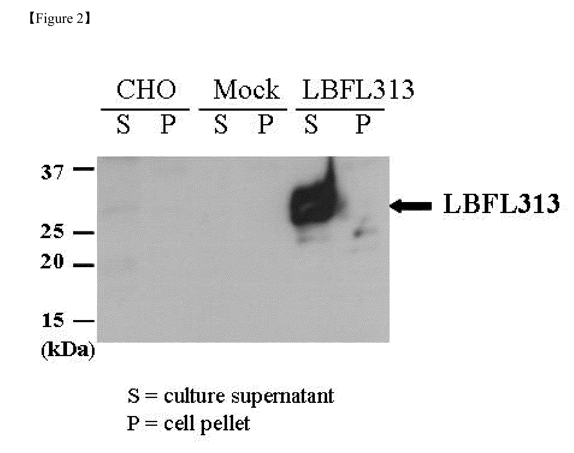 Gene family (lbfl313) associated with pancreatic cancer