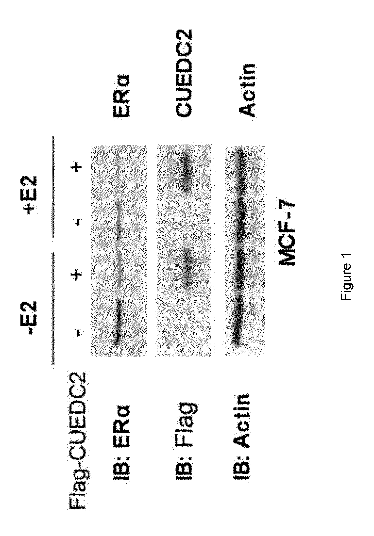 Molecular marker cuedc2 protein for prognostic determination of breast cancer endocrinology therapy