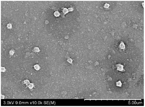 Cationization antheraea pernyi silk fibroin /adenovirus compound, and preparation method and application thereof