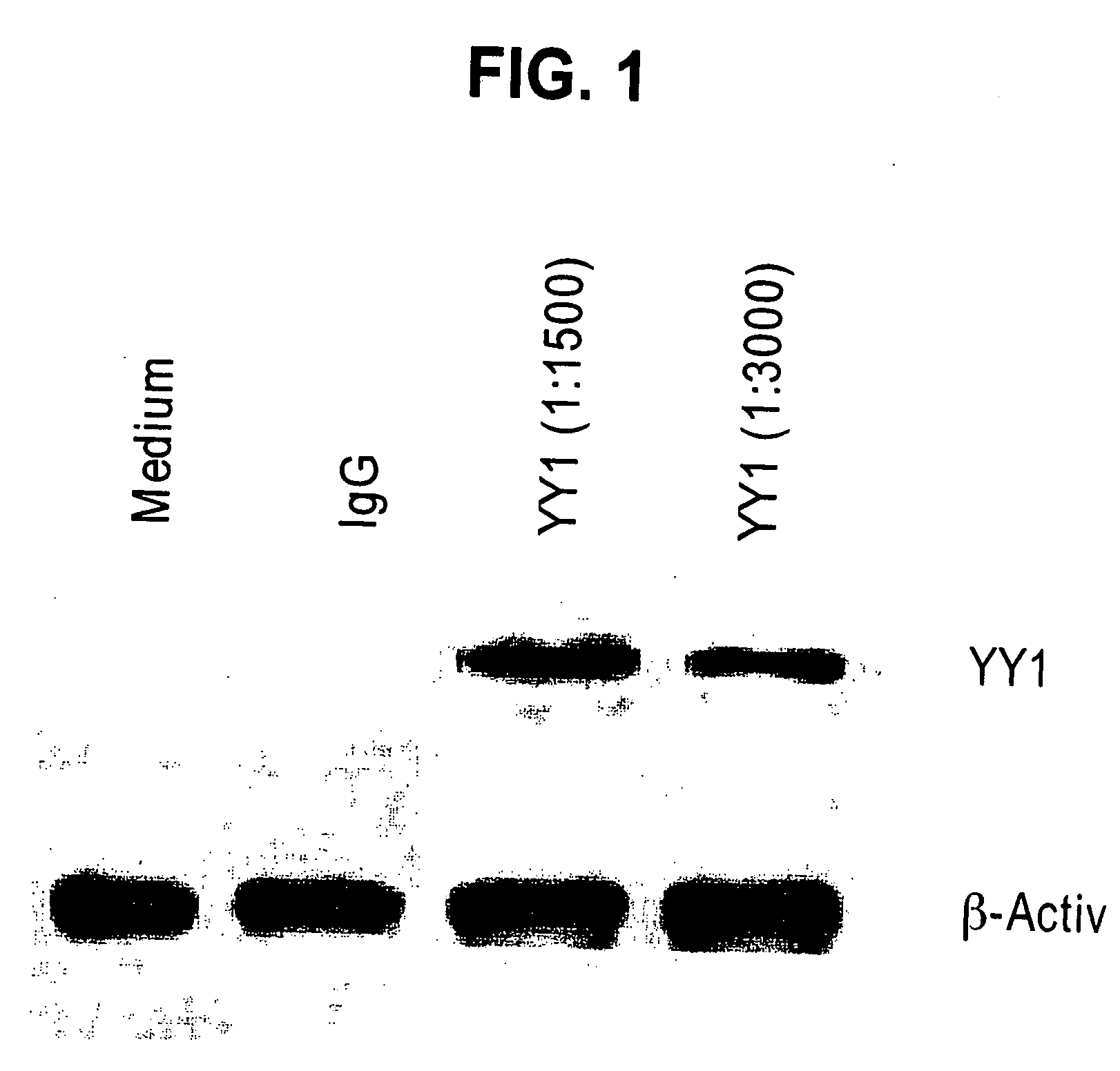 Therapeutic and Prognostic Factor Yy1 in Human Cancer