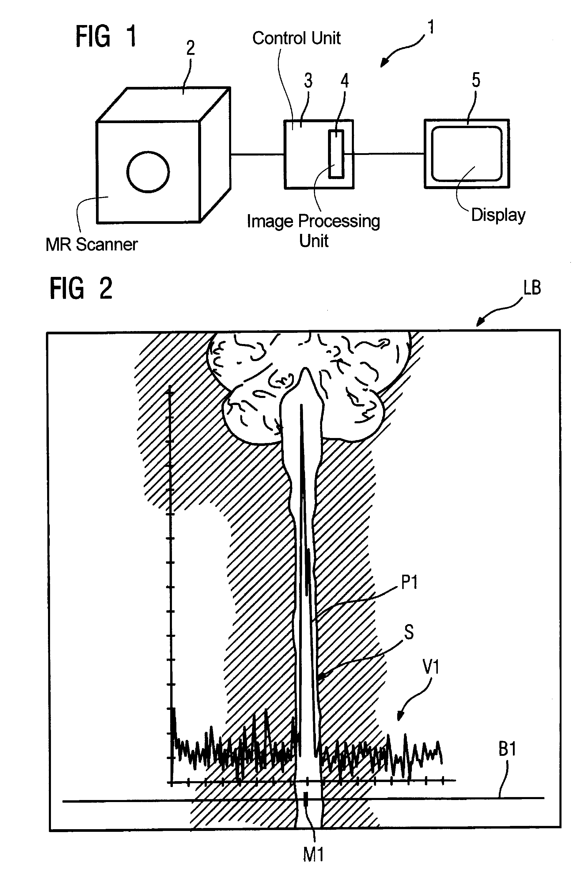 Method and magnetic resonance imaging apparatus for automatically determining the sagittal plane of a subject