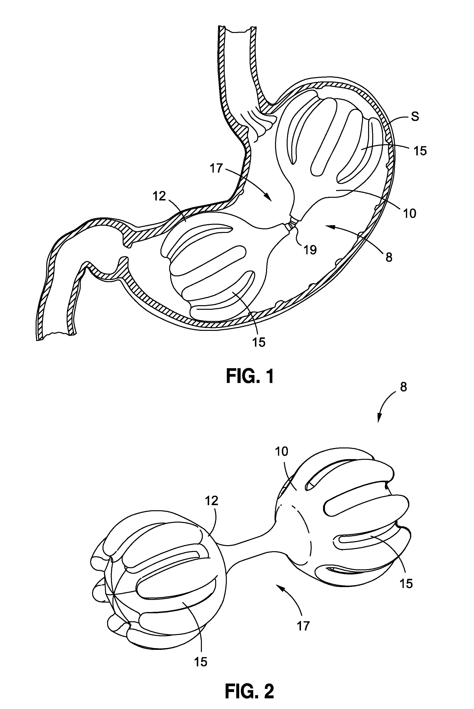 Intragastric implants with multiple fluid chambers