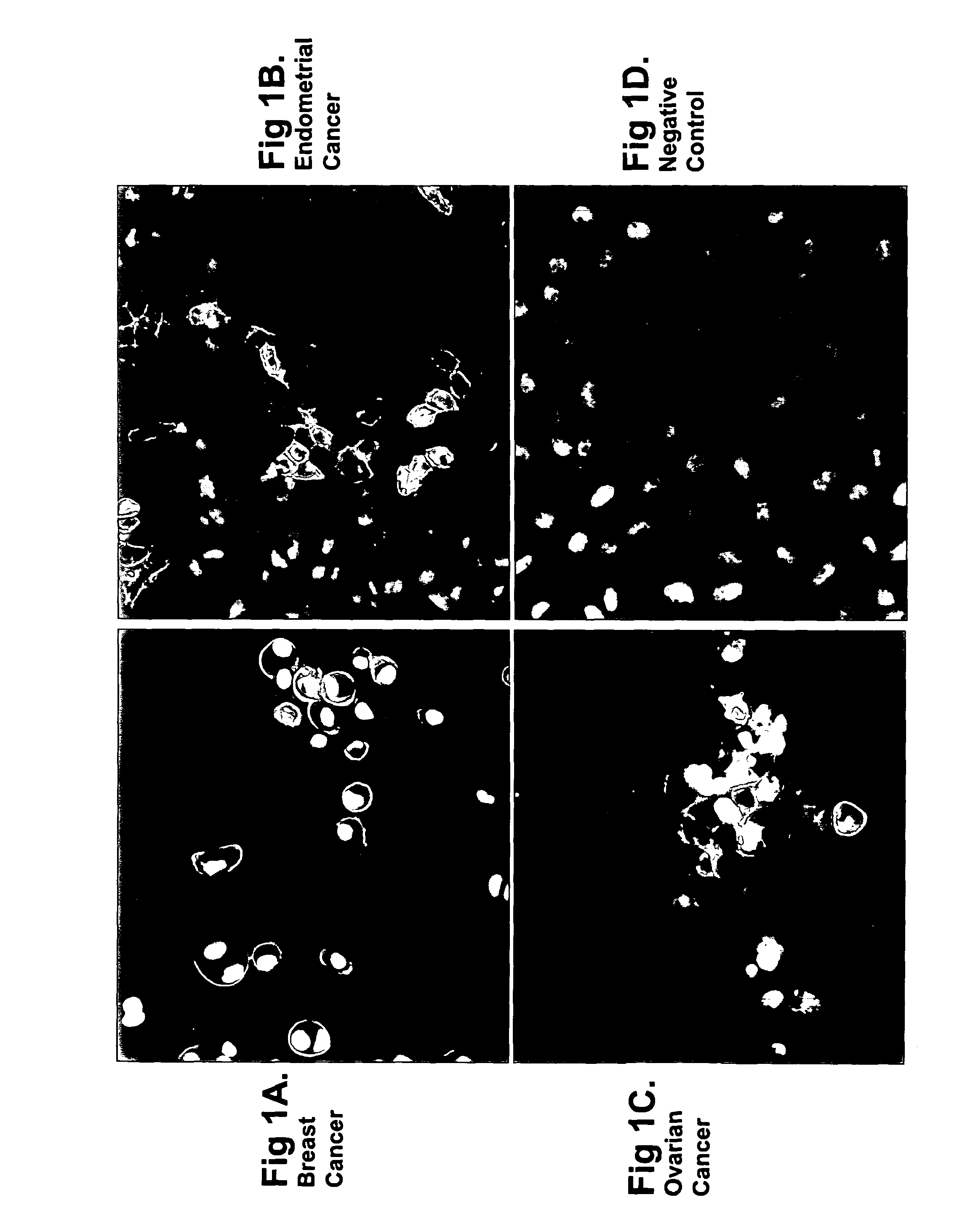 OVR110 antibody compositions and methods of use