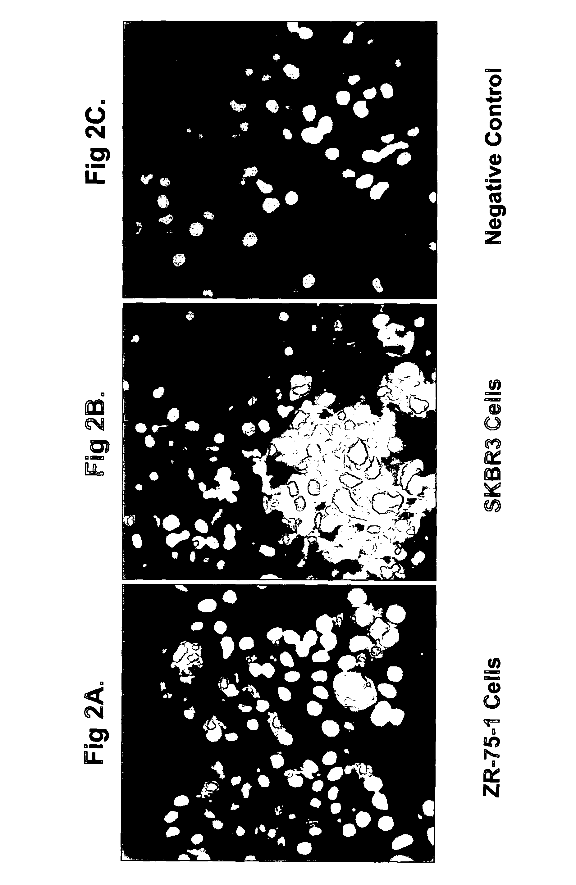 OVR110 antibody compositions and methods of use