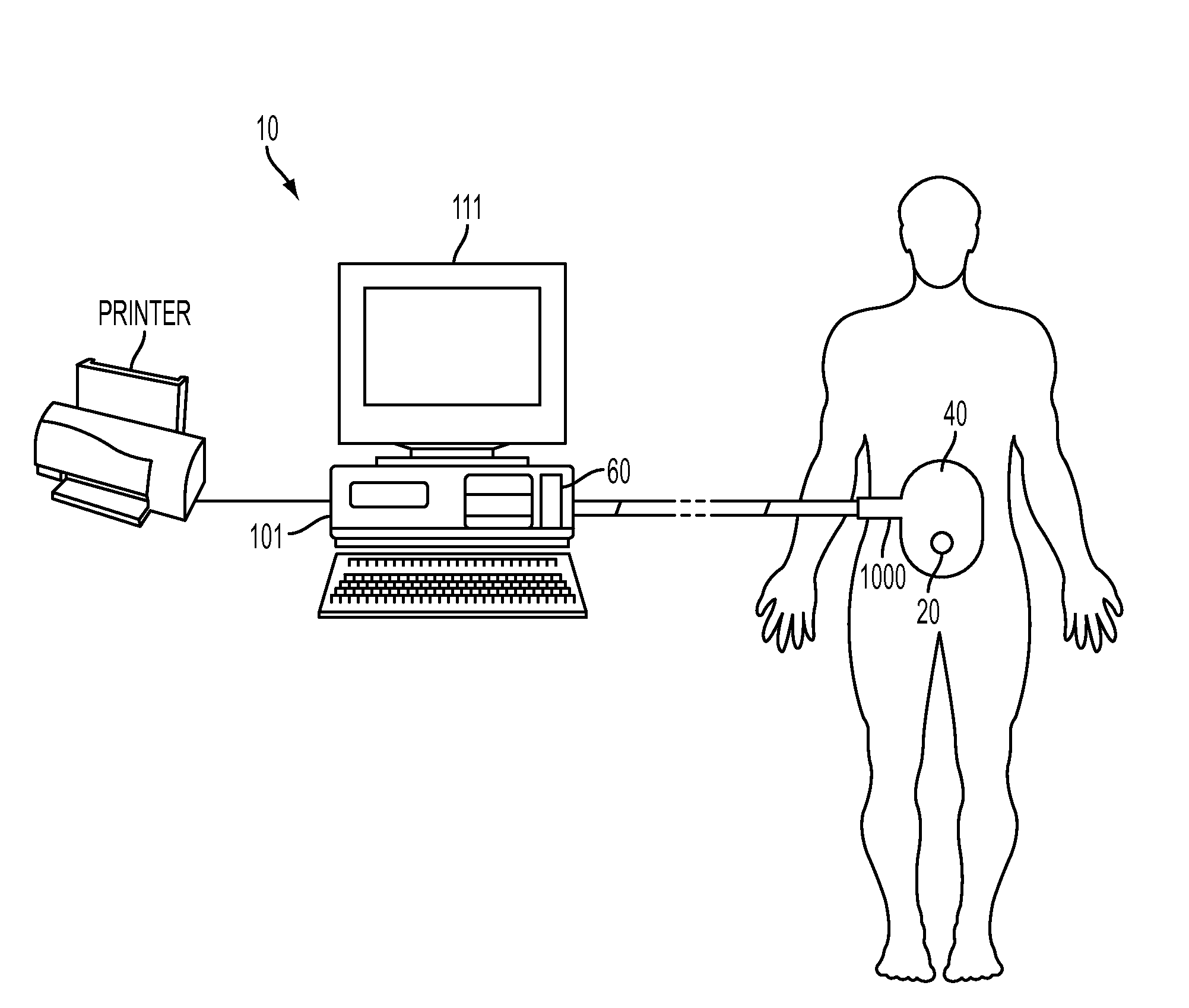 Method and system for treating cardiovascular disease