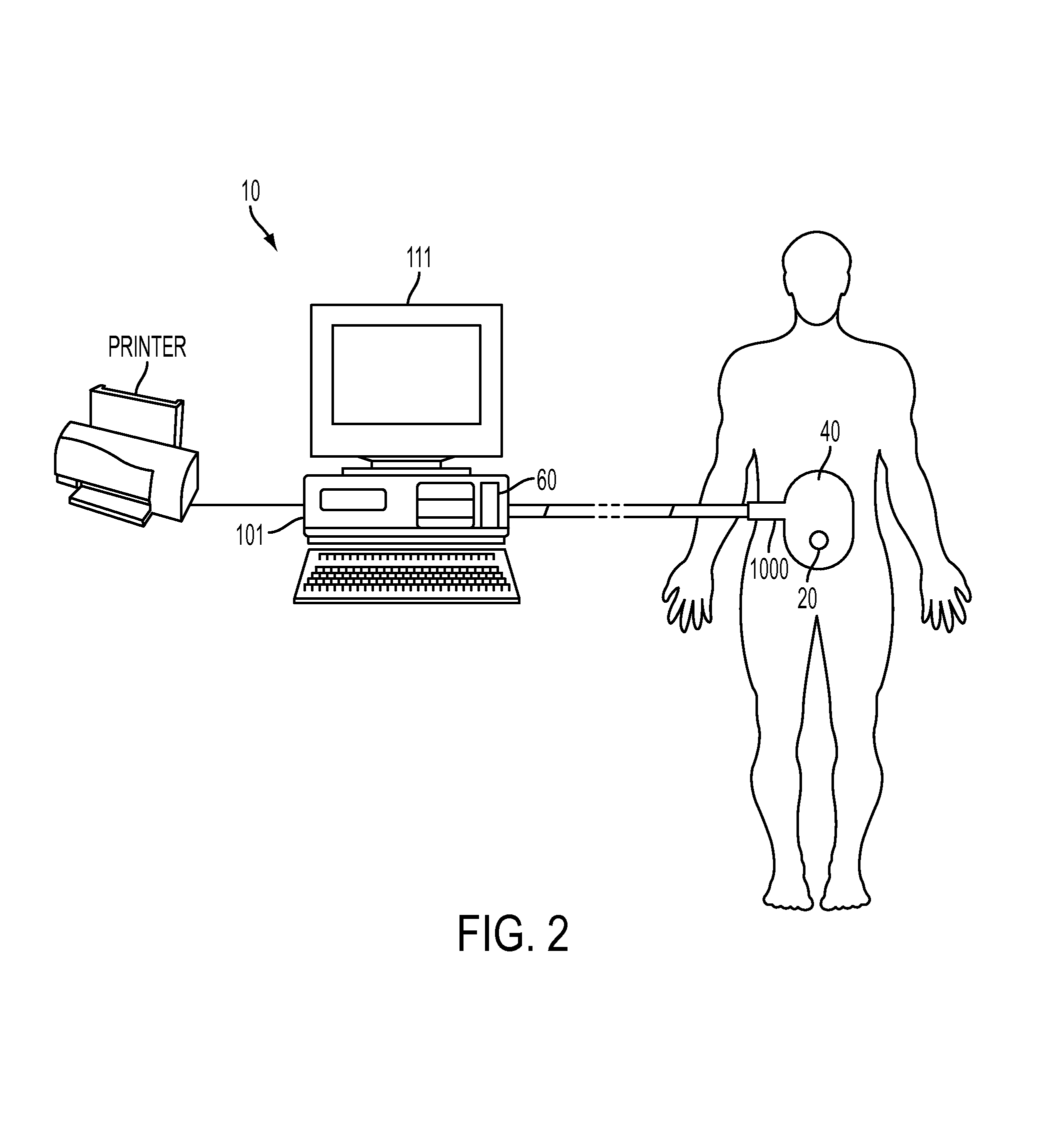 Method and system for treating cardiovascular disease