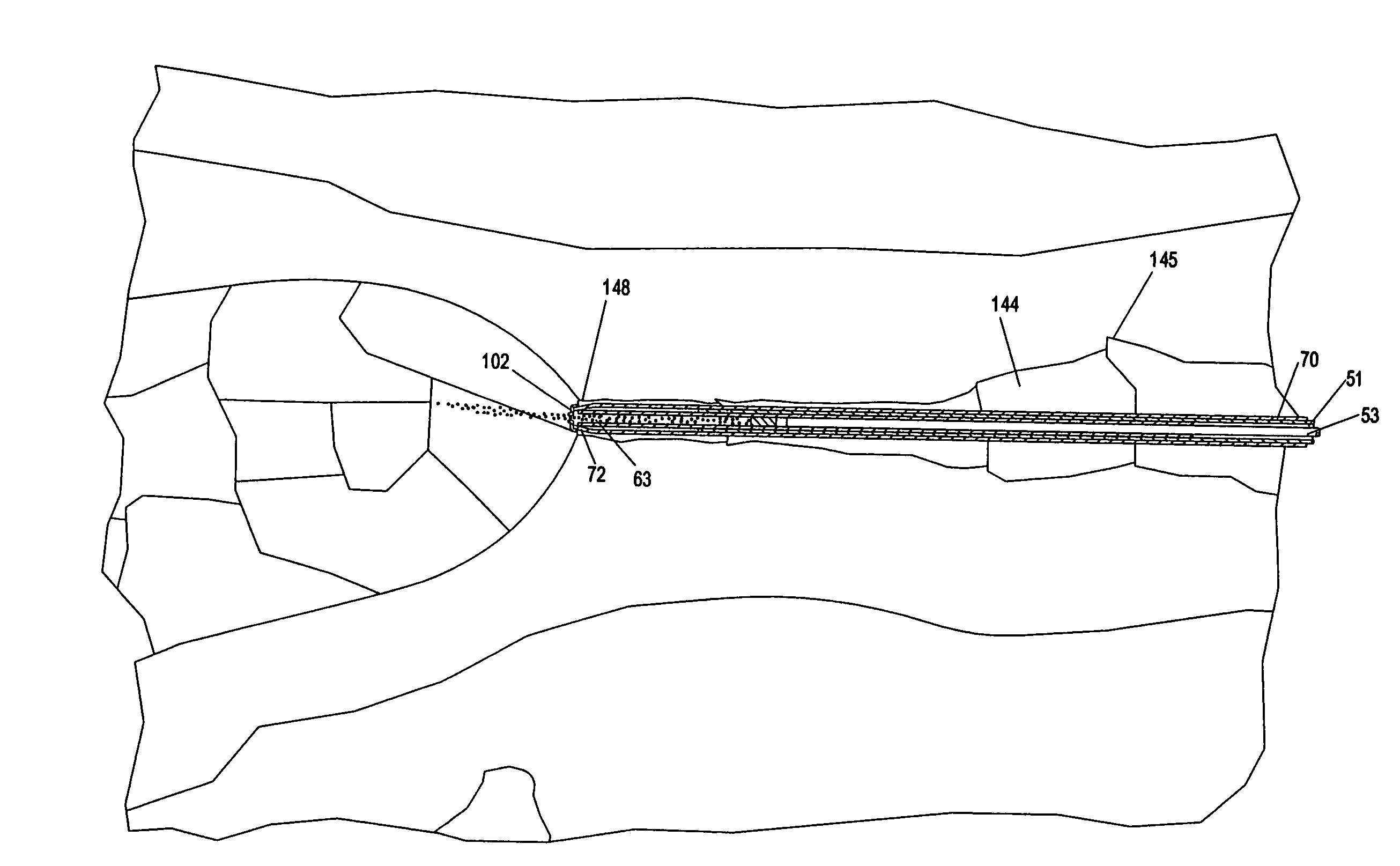 Animal insemination sheath