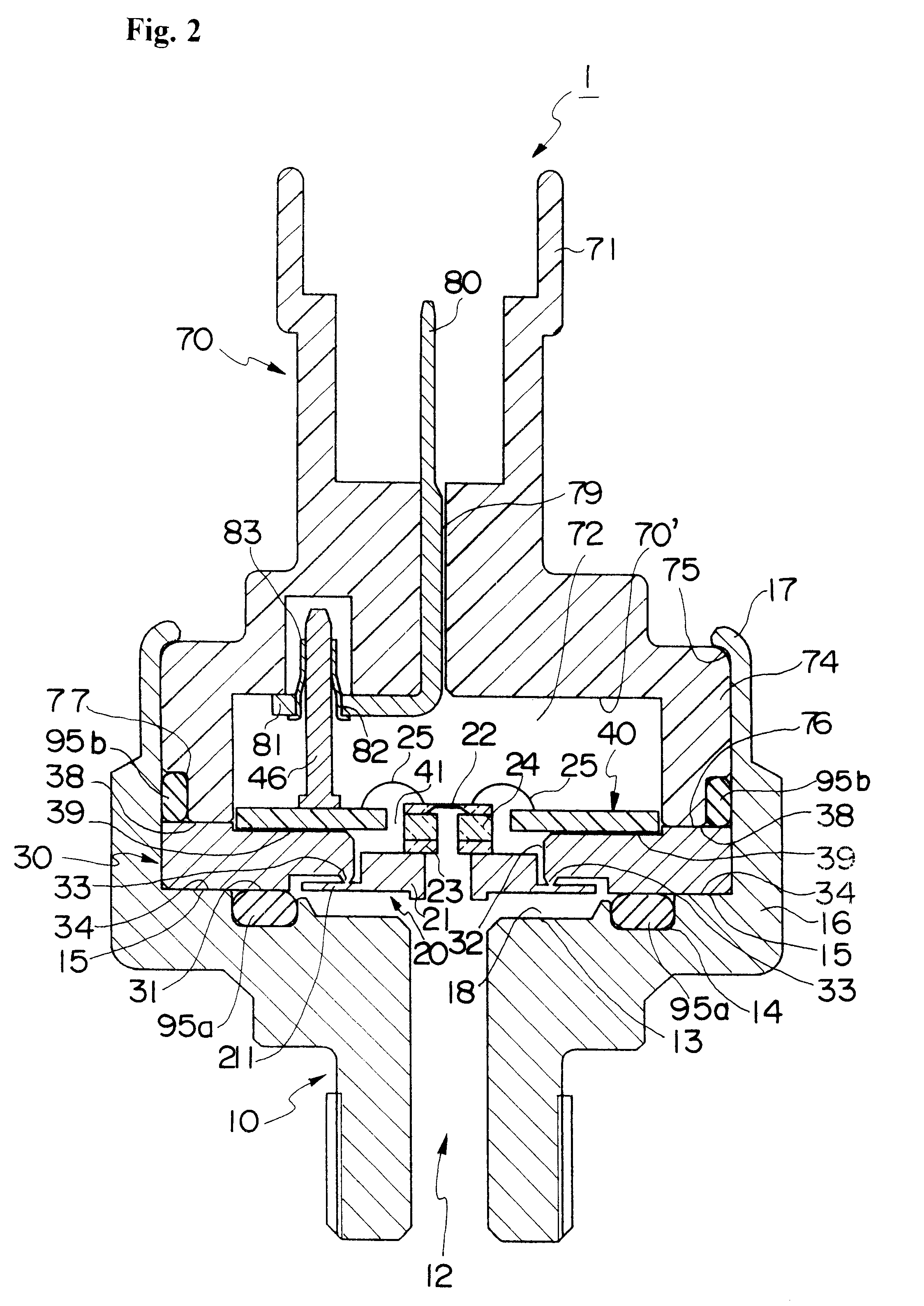 Pressure sensor